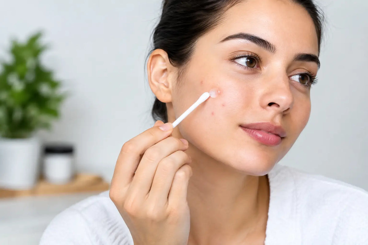 When to Use Spot Treatment for Clearer Skin